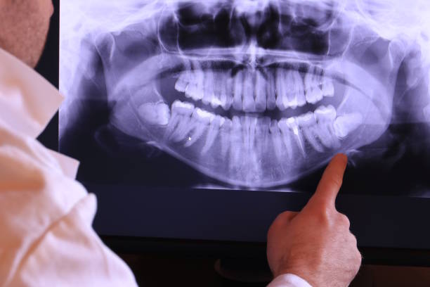 Best Urgent Care for Lost Fillings or Crowns in Deep River Center, CT